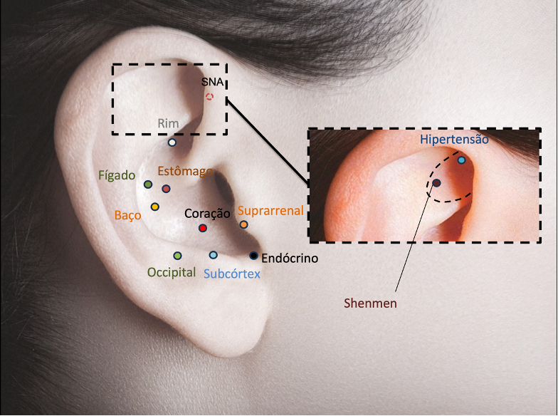 auriculoterapia_hipertensao
