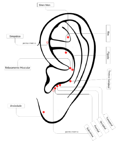 Acupuntura Auricular