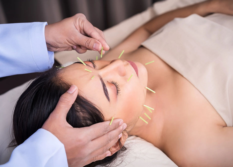 Curso de Acupuntura Estética Facial